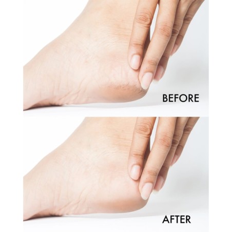 Crack Treat Cream 100 ml — Crème régénérante pour talons fissurés (usage salon)