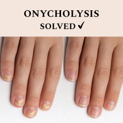 solution pour ongles fragiles Nail Recover FEHU soin renforçant