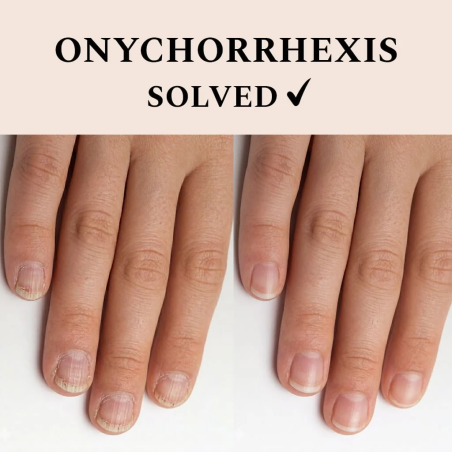solution pour ongles fragiles Nail Recover FEHU soin renforçant