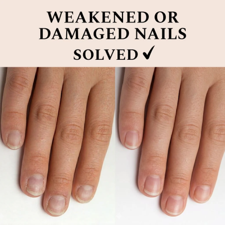 solution pour ongles fragiles Nail Recover FEHU soin renforçant