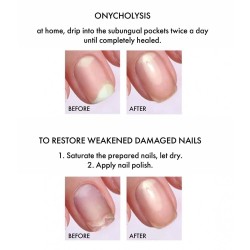 Antifungal Nail Growth Stimulator 9 ml – Prévention mycoses & croissance ongles